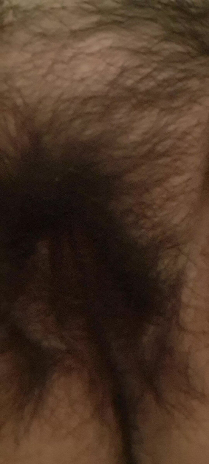 Mommy big hairy pussy: La figa pelosa di una miLF matura