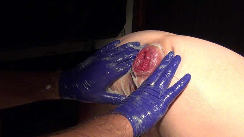 Marcus Pollack: Fisting Rosebutt Dari Pantatnya