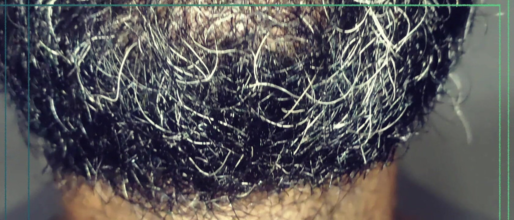 Rock F hairy: Tôi thức dậy vào ban đêm - tôi đã ghi lại điều này (tôi không...