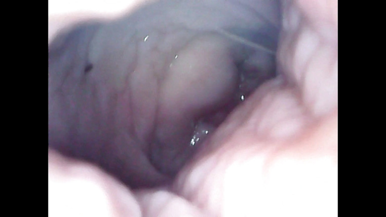 LizAngel: Me masturbo con un endoscopio en mi vagina
