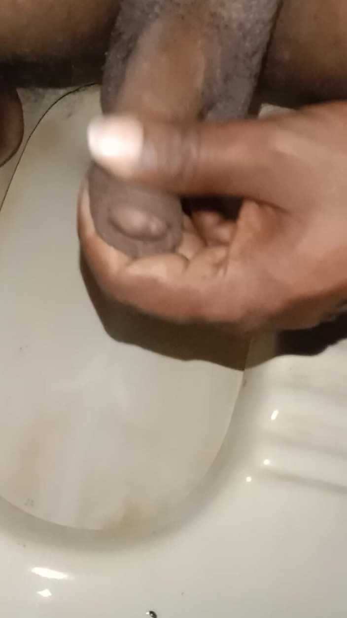 Camedi: Urinare dal pene