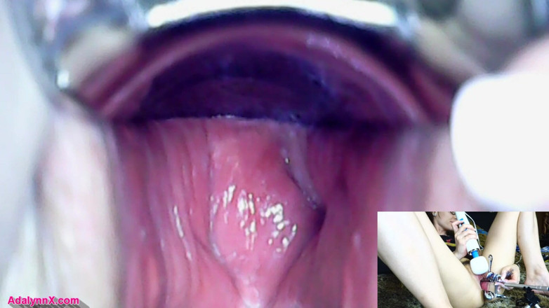 AdalynnX: AdalynnX - Endoscope speculum hitachi vib