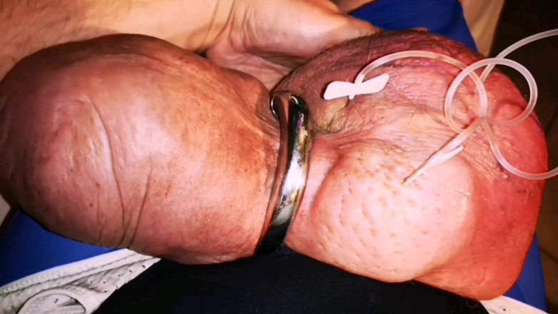 Monster_Meat_: Bahagian 2/ 10 Tampalan Aneh