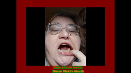 BBW nurse Vicki adventures with friends: Запитане відео дивиться в мій рот