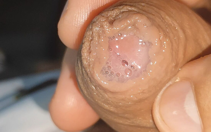 DaddyDoted: Nieuwsgierige Close-up Van Voorvocht in Slappe Fimose.