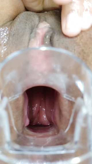 Xamy_97: Espansione anale con speculum