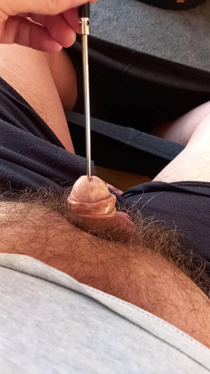 Peppol: Dilatazione dell'uretra