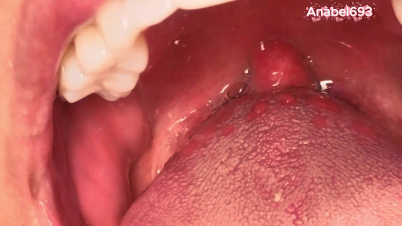 anabel693: Uvula