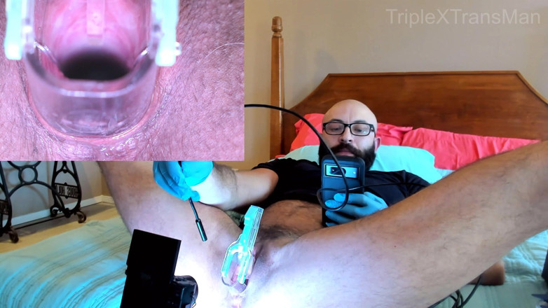 TripleXTransMan: Gyno Torment ve společnosti Tele anáh Doctor Visit, Medfet Gynecology...