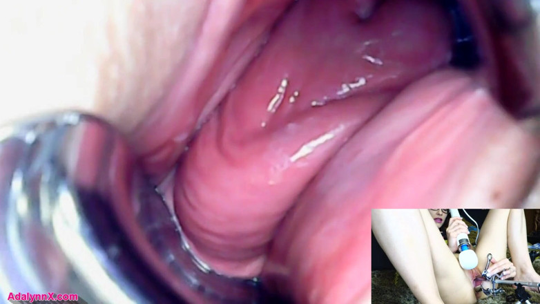 AdalynnX: AdalynnX - Endoscope speculum hitachi vib