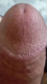 My Dick