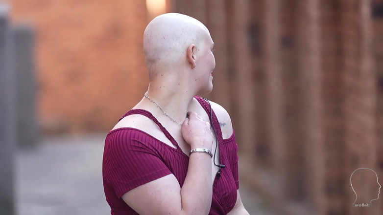Euro Bald: Emily