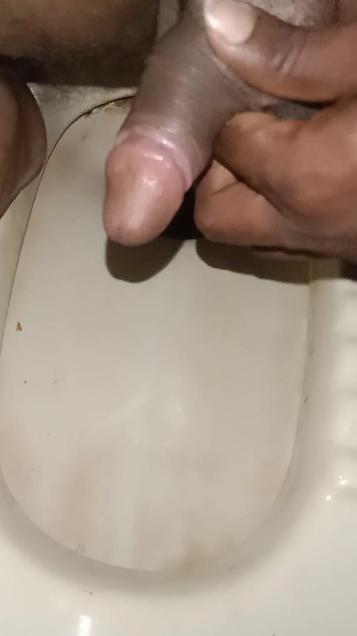 Camedi: Urinando do pênis