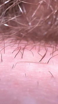 Macro skin sul mio cazzo