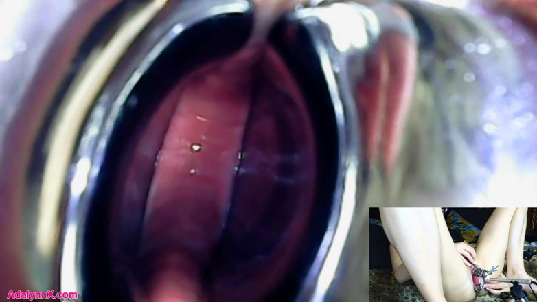 AdalynnX: AdalynnX - endoscopio espéculo hitachi vib
