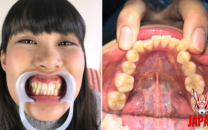 Japan Fetish Fusion: 歯の感覚:ブラッシング、知覚過敏、および陰謀
