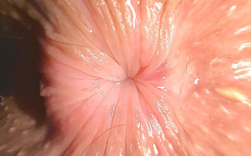 anus