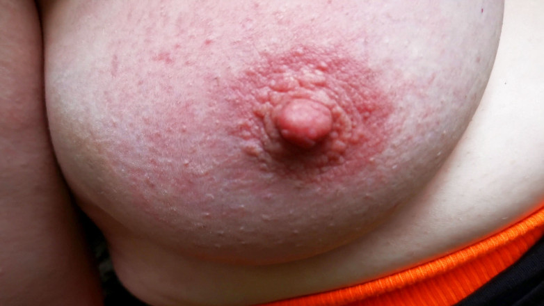 Bouncy Tits Action: Titslapping in the woods