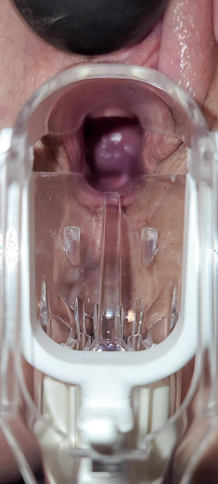 Contraby: Speculum Cervix Orgasmus Výstřik