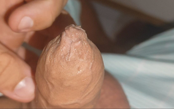 DaddyDoted: Large Healed Phimosis Holds the Cock Head