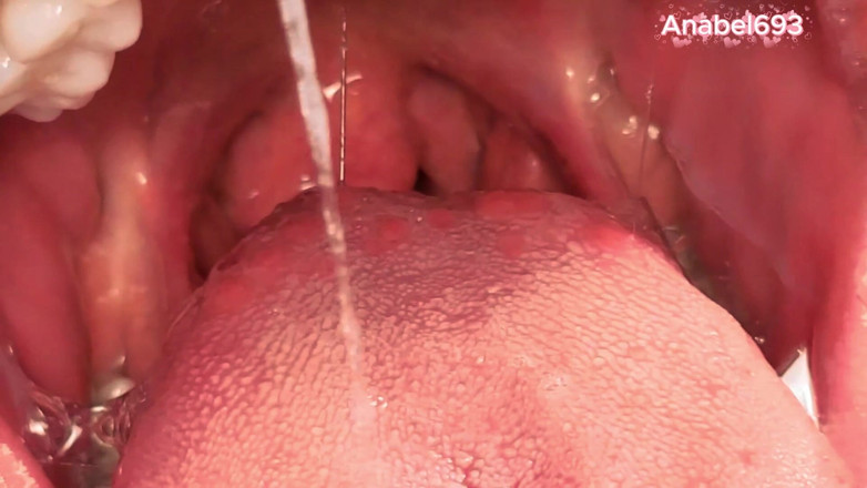 anabel693: Uvula