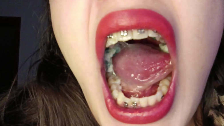 Golden domme: Consommer des chewing-gummies