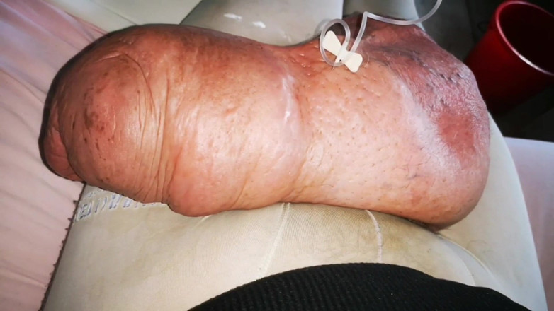 Monster_Meat_: Encore un énorme Infussion