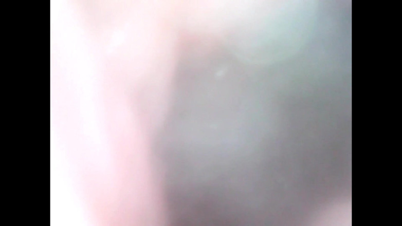 LizAngel: 再び私の膣に内視鏡を