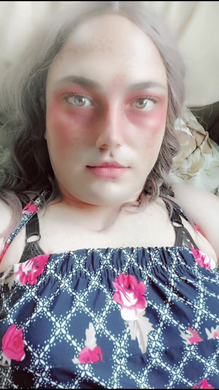 Kitty_Cross: Face Spanking Sissy Cute Crossdresser Slut White Big Natural Boobs...