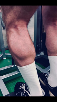 My Legs