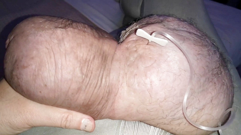 Monster_Meat_: Doi litri de glucoză în siliconul meu de 1380cc