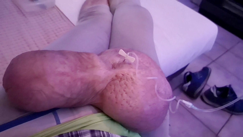 Monster_Meat_: Remplir de glucose 1liter