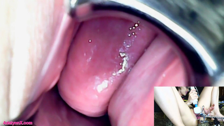 AdalynnX: AdalynnX - endoscoop speculum hitachi vib