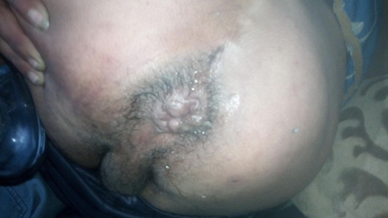 Vane_69_anal: Expansion part 1