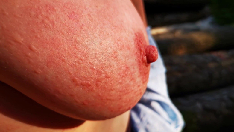 Bouncy Tits Action: Isırgan cezalandırma günü - açık havada göt, memeler ve vajina - dc