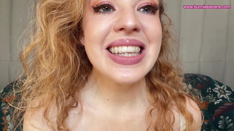 Bunnie Stevens: Ich probiere meine aligner an - Teil 2
