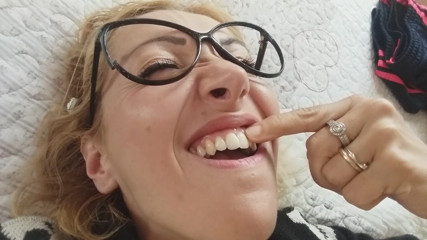 savannahamatoriale: Мои зубы и десны!