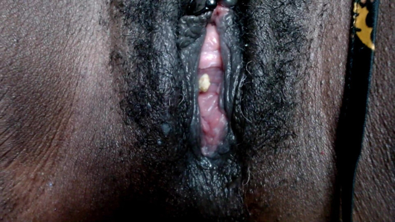 Maeling: dabal tinij mamiphaid pusi ingest men dhakka diya gaya: ek