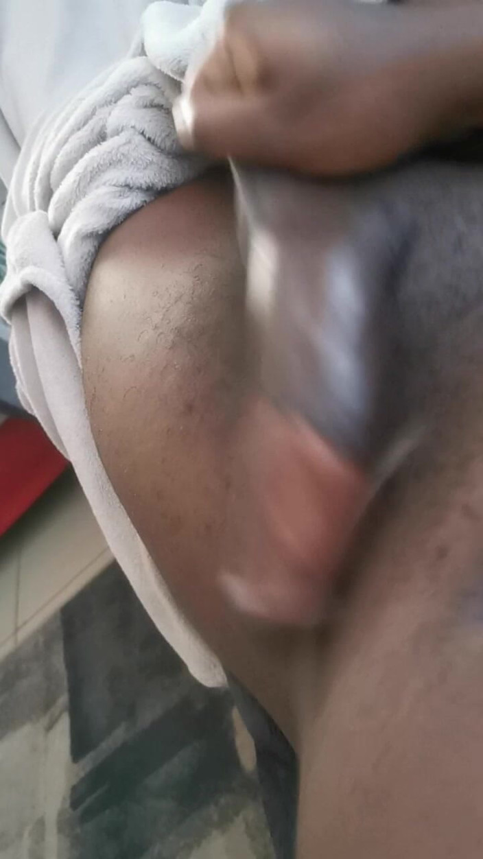 Rex Bitchington Blade: Grote lul 2