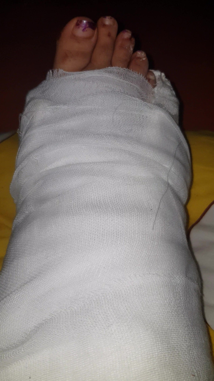 LoraBbw: Wydymanie moich palce w obsadzie