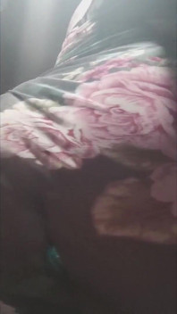6650151