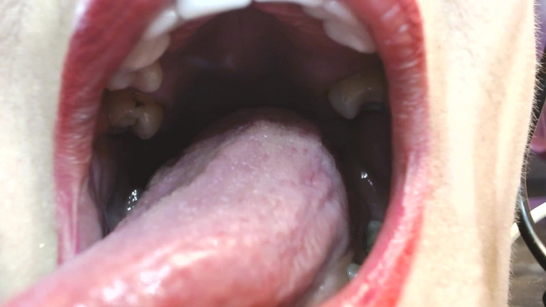 Abby Anna: Dans ma grosse bouche, dents de langue, uvule