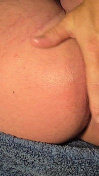 Brazilian Wax Asshole