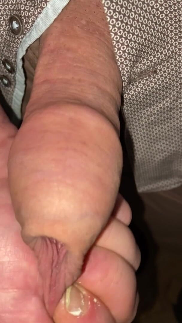 Foreskinguy: 在他自己的包皮中未割包皮射精