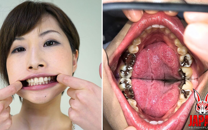 Japan Fetish Fusion: दांत निरीक्षण इतिहास: Yua Hidaka के रहस्यपूर्ण मौखिक दायरे में गोता लगाओ