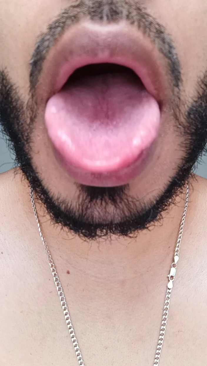 Tommhot: Mostrando Partes De Primer Plano De Mi Cuerpo