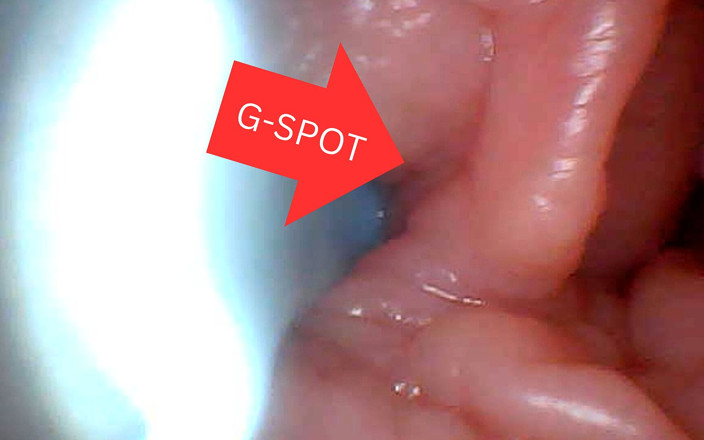 Twittiy: Primera vez: un endoscopio revela el punto G de cerca -...