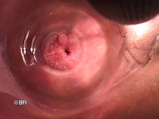 Pegging insertion: 奇怪的文件 162