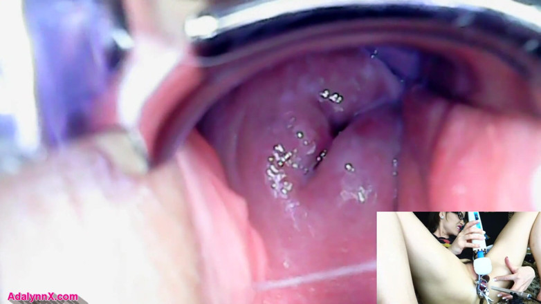 AdalynnX: AdalynnX - Endoscope speculum hitachi vib