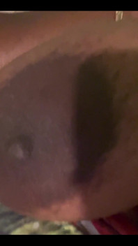 25460764